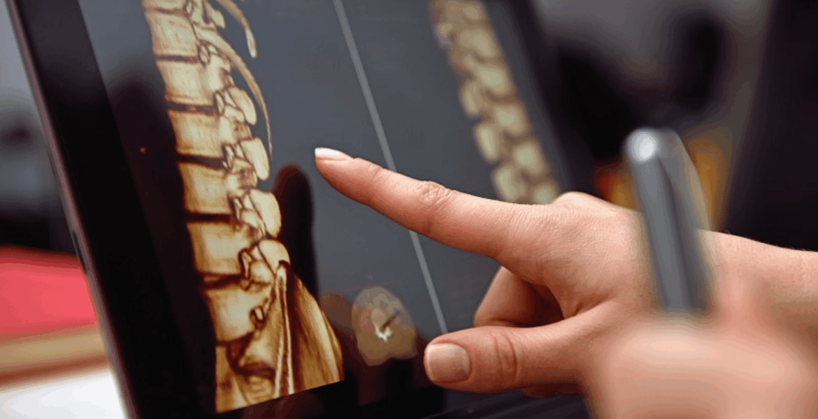 Spinal Cord Injury Care