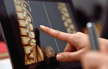 Spinal Cord Injury Care