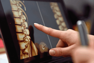 Spinal Cord Injury Care