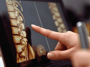 Spinal Cord Injury Care